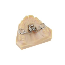 Surub disjunctie CAD/CAM Anatomical Expander 8mm Leone