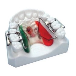 Arc palatinal pentru dispozitivul de distalizare First Class Leone