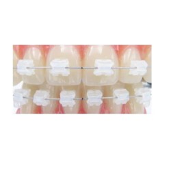 Bracketi Ceramici sistem Aqua Roth 20 bucati per cutie Leone