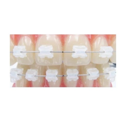 Bracketi Ceramici sistem Aqua Roth 20 bucati per cutie Leone