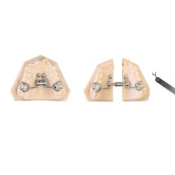 Surub disjunctie Telescopic CAD – CAM Expander 14mm Leone