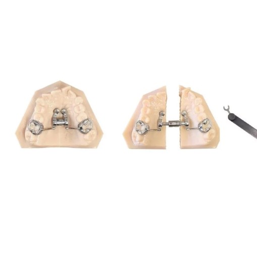 Surub disjunctie Telescopic CAD – CAM Expander 14mm Leone