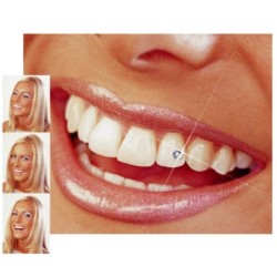 Bijuterie dentara Skyce Crystal Refill 1.8mm Ivoclar